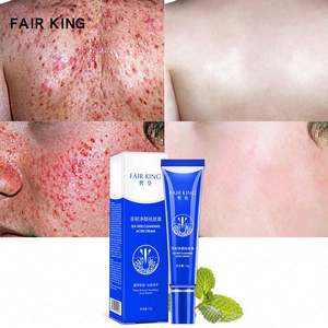 Usine FAIR <span class=keywords><strong>KING</strong></span> Traitement Élimination des points noirs Anti-crème Contrôle de l'huile Rétrécir les pores Cicatrice d'acné Supprimer les soins du visage Blanchiment 15g - Product Image 3
