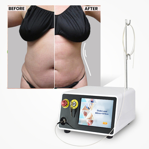 Dispositivo láser de diodo de liposucción para estiramiento de la piel flácida de los <span class=keywords><strong>brazos</strong></span> internos de la pierna superior abdominal - Product Image 4