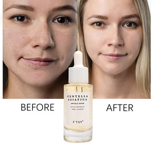 Suero Facial Ampolla de Centella Asiática de Madagascar con Logotipo Personalizado, Calma la Piel Sensible Propensa al Acné - Product Image 6