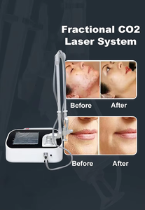 Máquina de Rejuvenecimiento Vaginal con Láser Fraccional de CO2 DZ0035, la Más Vendida del 2026, Dispositivo para el Cuidado de la Piel, Profesional para Salones de Belleza - Product Image 2