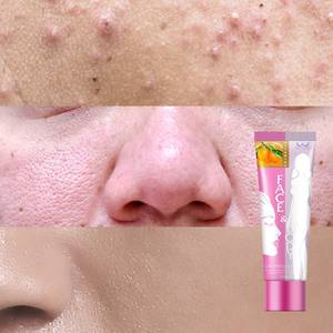 Crème exfoliante naturelle blanchissante Apple, éclaircissante, B12, 250 ml, corps E & F, Ace, vente en gros - Product Image 3