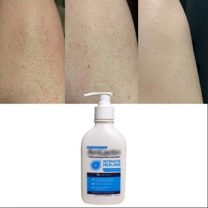 Lozione Corpo Extra Schiarente Biologica Idratante per <span class=keywords><strong>Pelle</strong></span> da <span class=keywords><strong>Secca</strong></span> a <span class=keywords><strong>Molto</strong></span> <span class=keywords><strong>Secca</strong></span> - Product Image 2