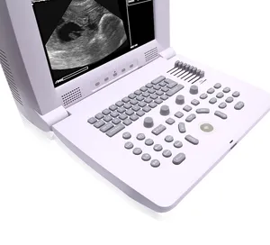 KY-3018VP Veterinaire Draagbare Ultrasone Scanner, Dieren B-Echografie, Draagbare Veterinaire Echografie - Product Image 3