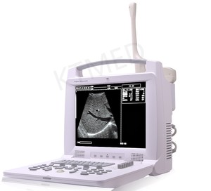 KT-A012 Portable Digital VET/human B/W Ultrasound Laptop Type Black and White Ultrasound Scanner Machine for <strong>Pregnancy</strong> - Product Image 6