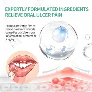 <span class=keywords><strong>Gel</strong></span> Bucal Portátil con Hierbas Antibacterianas para Aliviar el Dolor de Muelas, Dolor Oral, Dolor Periodontal, Úlceras Aftosas y Ampollas - Product Image 3