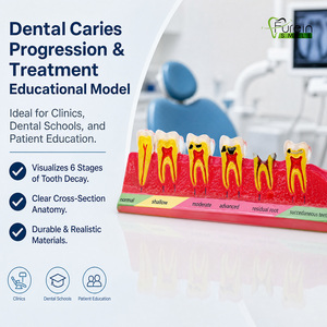 Modèle éducatif sur la progression des caries dentaires, directement de l'usine, pour les cliniques dentaires, les écoles et la formation des patients. Marque privée. - Product Image 2