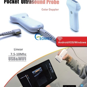 Sonde d'échographie Doppler couleur sans fil et USB, format paume, pour usage vétérinaire et humain, extrêmement économique, à bas prix CU07, CU08 - Product Image 5