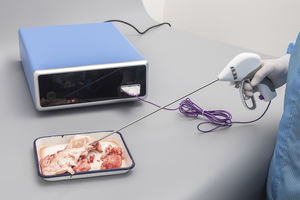 Elektrische Ligasure Vat Afdichting Instrument Set Omvat Maryland Chirurgische Instrument Ligasure Vat Afdichting Sealer - Product Image 6