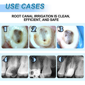 S1 #21mm di alta qualità dentale <span class=keywords><strong>Endo</strong></span> <span class=keywords><strong>file</strong></span> blu rotanti materiale Niti viola anello strumento dentista per il trattamento canalare - Product Image 5