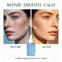 Serum Peptida FKY GHK-Cu Snap-8 untuk Microneedling, Esens Peremajaan Kulit
