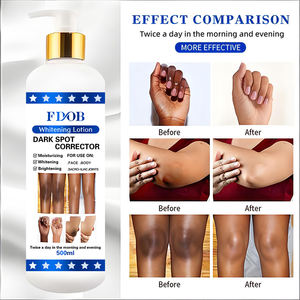 Lotion <span class=keywords><strong>pour</strong></span> <span class=keywords><strong>le</strong></span> <span class=keywords><strong>corps</strong></span> blanche biologique de marque privée lait hydratant <span class=keywords><strong>crème</strong></span> blanchissante <span class=keywords><strong>pour</strong></span> peau noire élimine les taches - Product Image 5