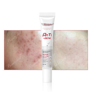 Extractos de Plantas Naturales, Gel para el Tratamiento de Manchas de Acné, Calmante para el Acné, Reparación de Cicatrices, Crema para el Tratamiento del Acné - Product Image 6