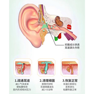 Liquide nettoyant pour le conduit auditif Teiener 20 ml, hydratant doux pour les soins externes de l'oreille - Product Image 3