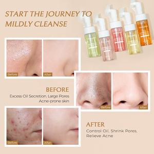 Mousse <span class=keywords><strong>nettoyante</strong></span> pour le <span class=keywords><strong>visage</strong></span> hydratante personnalisée contre les points noirs et les pores, à base de curcuma et de safran, avec <span class=keywords><strong>brosse</strong></span> - Product Image 3