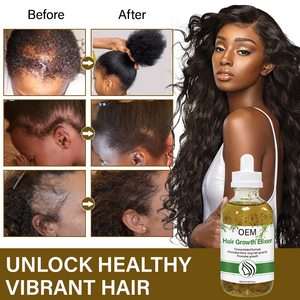 Huile <span class=keywords><strong>de</strong></span> Massage Capillaire Personnalisée Bio et Végane à Base <span class=keywords><strong>de</strong></span> Plantes, Fortifiante pour le Cuir Chevelu, <span class=keywords><strong>Infusion</strong></span> <span class=keywords><strong>Romarin</strong></span>, Menthe et Ricin pour une Croissance Extrême des Cheveux - Product Image 6