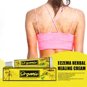 Cura del corpo Non irritante secca prurito Eczema alleviare crema Eczema crema curativa a base di erbe per il corpo