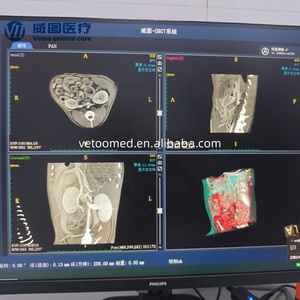 Vetoo DX-Auto Plus – Machine de tomodensitométrie vétérinaire certifiée CE avec C-bras pour animaux – Diagnostic avancé des os, des articulations, des tumeurs et de la dentisterie – Image claire - Product Image 6