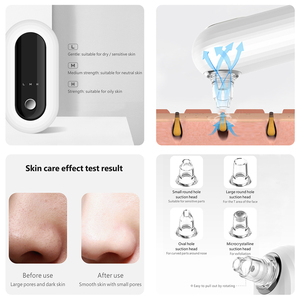 Extracteur de points noirs électrique en plastique, 4 têtes, aspirateur, nettoyant facial, massage, fonction de lifting, instrument de beauté de la peau, utilisation du nez - Product Image 3