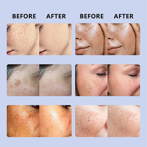 Crème Visage Anti-Rides Réparatrice au Peptide de Cuivre <span class=keywords><strong>Bleu</strong></span> et Acide Hyaluronique – Éclaircit et Illumine les Peaux Foncées, Améliore l'Éclat - Product Image 6