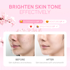 FENYI vente chaude soins de la peau <span class=keywords><strong>japonais</strong></span> fleur de <span class=keywords><strong>cerisier</strong></span> hydrosol blanchissant éclaircissant visage Toner 100ml - Product Image 5