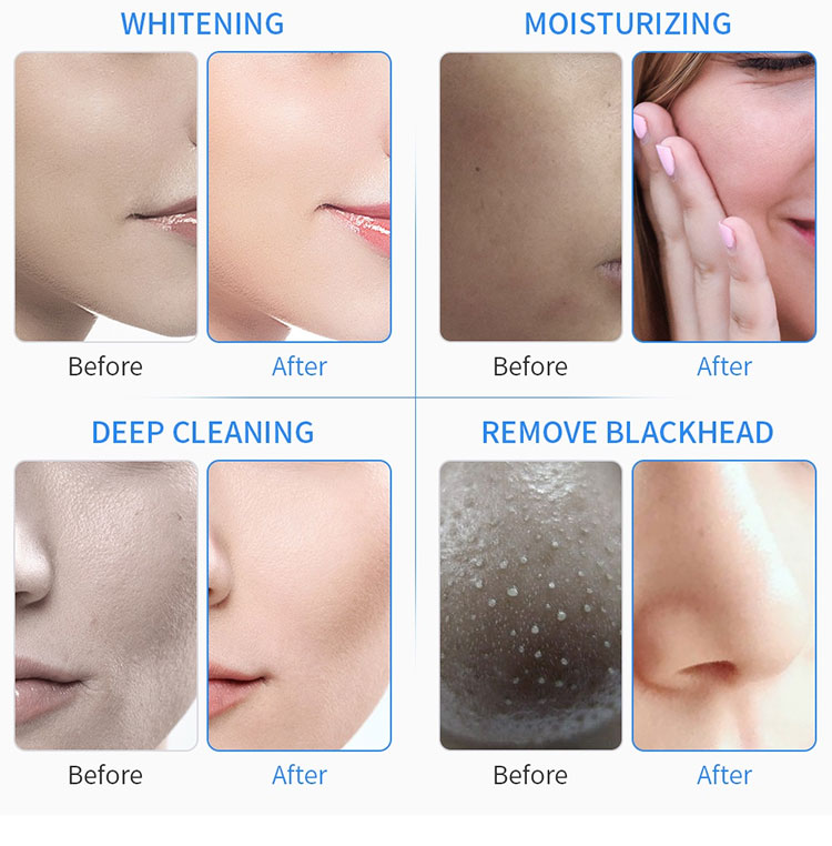 6 in 1 hydrogen oxygen small bubble facial cleaning h202 oxygen filling hydrating beauty equipment