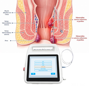Máquina Láser Eficaz para Hemorroides, Equipo Médico de Corte Láser para Proctología de 980nm y 1470nm Utilizado por Proctólogos - Product Image 2