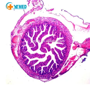 Lehre zubehör Gemischten menschlichen oral pathologie medizinische vorbereitet folien