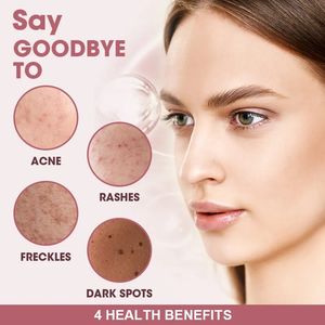 खमीर प्राकृतिक एल-ग्लूटाथियोन गुम्मस सफेद चमकी त्वचा त्वचा चमकदार सुंदरता गुम्मस एंटी-ऑक्सीडेंट कोलेजन - Product Image 3