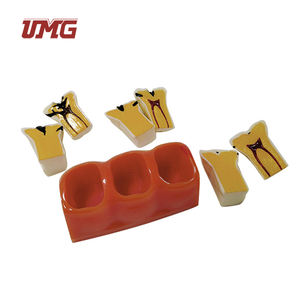 Modelo educativo de ciencia médica, modelo de desmontaje de caries de tamaño 4 veces - Product Image 3