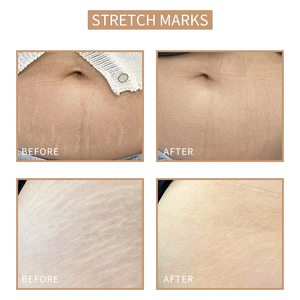 Micropigmentación Scar Cover estrías pigmentos <span class=keywords><strong>de</strong></span> camuflaje con <span class=keywords><strong>tatuajes</strong></span> <span class=keywords><strong>de</strong></span> cicatrices - Product Image 3