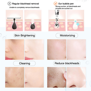 Máquina Portátil de Hidrofacial Aqua Peel Hydradermabrasion para Limpieza Profunda de la Piel, Exfoliación de la Piel, Cuidado Facial, Oxigenoterapia Facial - Product Image 4