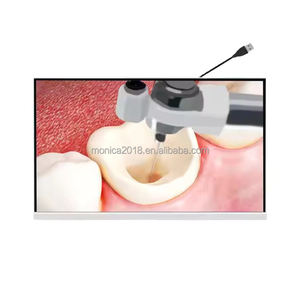 Équipement dentaire de produits <span class=keywords><strong>Micro</strong></span> caméra visuelle à lentille <span class=keywords><strong>micro</strong></span> pour le traitement du canal radiculaire <span class=keywords><strong>Micro</strong></span> caméra orale HD dentaire - Product Image 4