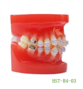 Modello dentale con anello di legatura del filo dell'arco Ortho staffa in ceramica modello di protesi modello di pratica <span class=keywords><strong>standard</strong></span> - Product Image 3