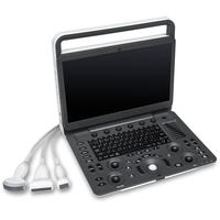Système d'échographie vétérinaire noir et blanc SonoScape E1V portable avec écran de 15,6 pouces pour chiens, chats, bétail et animaux d'élevage
