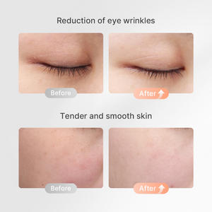 Pour TOUCHBeauty 3-en-1 appareil de Massage de la peau du visage à microcourant portable alimenté par USB pour le corps du visage écran LCD appareil de beauté à domicile - Product Image 4