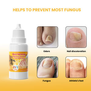 น้ำมันบรรเทาอาการเล็บขบสูตรเข้มข้นพิเศษ ผลิตภัณฑ์ดูแลสุขภาพสำหรับรักษาเชื้อราที่เล็บเท้า ช่วยฟื้นฟูเล็บที่เสียหายและเปลี่ยนสี - Product Image 3
