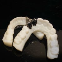 Grillz dentaire personnalisé en argent 925 avec lettre R gothique et moissanite VVS complète, bijoux HipHop