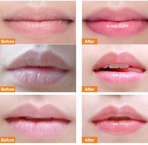 ลิปสครับและบาล์มมังสวิรัติออร์แกนิกปรับแต่งได้2:1สตรอเบอรี่บำรุงริมฝีปากติดป้ายยี่ห้อส่วนตัว - Product Image 2