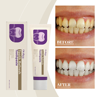 Dentifrice Rafraîchissant et Blanchissant pour des Dents Éclatantes – Nettoie Doucement les Taches et la Saleté des Dents – Dentifrice Anti-Taches OEM