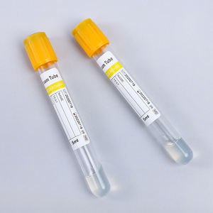 Provetta per Prelievo di Sangue Sottovuoto in PET con Gel e Attivatore del Coagulo, Coperchio Giallo, Certificata CE, Prezzo di Fabbrica - Product Image 4