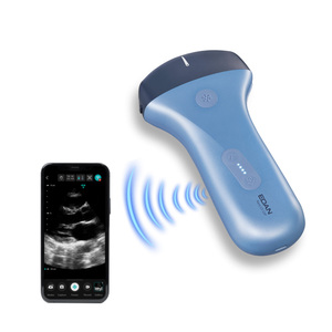 Échographe <span class=keywords><strong>portable</strong></span> sans fil <span class=keywords><strong>Edan</strong></span> Nano C5 EXP avec sonde convexe pour diagnostic abdominal <span class=keywords><strong>portable</strong></span> - Product Image 6