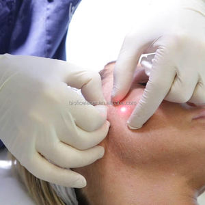 Machine à <span class=keywords><strong>laser</strong></span> diode endo 980 1470 nm pour la beauté, les soins personnels, le lifting du visage, la chirurgie, les mycoses des ongles, l'élimination des vaisseaux sanguins du visage - Product Image 3