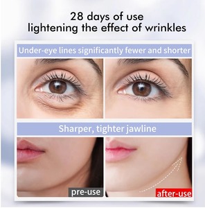 Appareil de soin de la peau de voyage à 360 degrés, baguette de beauté, luminothérapie, micro-courant et masseur oculaire vibrant - Product Image 4