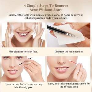 Kit d'outils pour éliminer les points noirs, extracteur de comédons, ensemble d'aiguilles pour éliminer les imperfections du nez, du <span class=keywords><strong>visage</strong></span>, des pores, des points blancs - Product Image 3