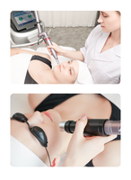 Picocare — laser pour enlever les tatouages, 9 pièces, enlèvement des tatouages, machine, picoseconde, interrupteurs q, nd yag pico