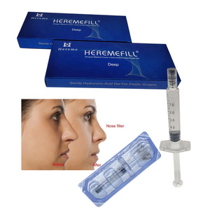 Factory <strong>Price</strong> CE Approved High Cross Linked Hyaluronic Acid <strong>Lip</strong> Plump Nose Shape Dermal Filler Cheek Chin <strong>Injection</strong> - Product Image 3