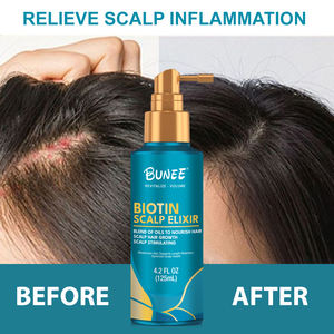 125ml Acondicionador a base de hierbas para el crecimiento del cabello Romero Elixires Cuero cabelludo Línea de cabello Engrosamiento Tratamiento Argan Rogain Aceite de biotina Pérdida de cabello - Product Image 2