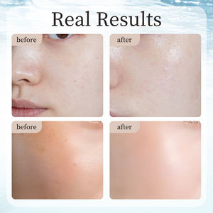 CHEME Anti-Aging 50g kollajen peptidleri parlatıcı krem anti-kırışıklık yüz nemlendirici cilt bariyeri nemlendirici cilt bakımı artırmak için - Product Image 5