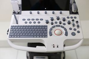Diagnóstico asistido por IA Sonoscape P40 Elite Digital Color Doppler Ultrasonido Máquina 3D 4D Máquina De Ultrasonido para cardiología - Product Image 4
