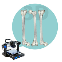Servicio de Impresión 3D de Alta Precisión, Prototipado Rápido SLS SLM SLA para Metal, Nailon, PEEK, Modelos Médicos, Piezas y Accesorios de Automóviles